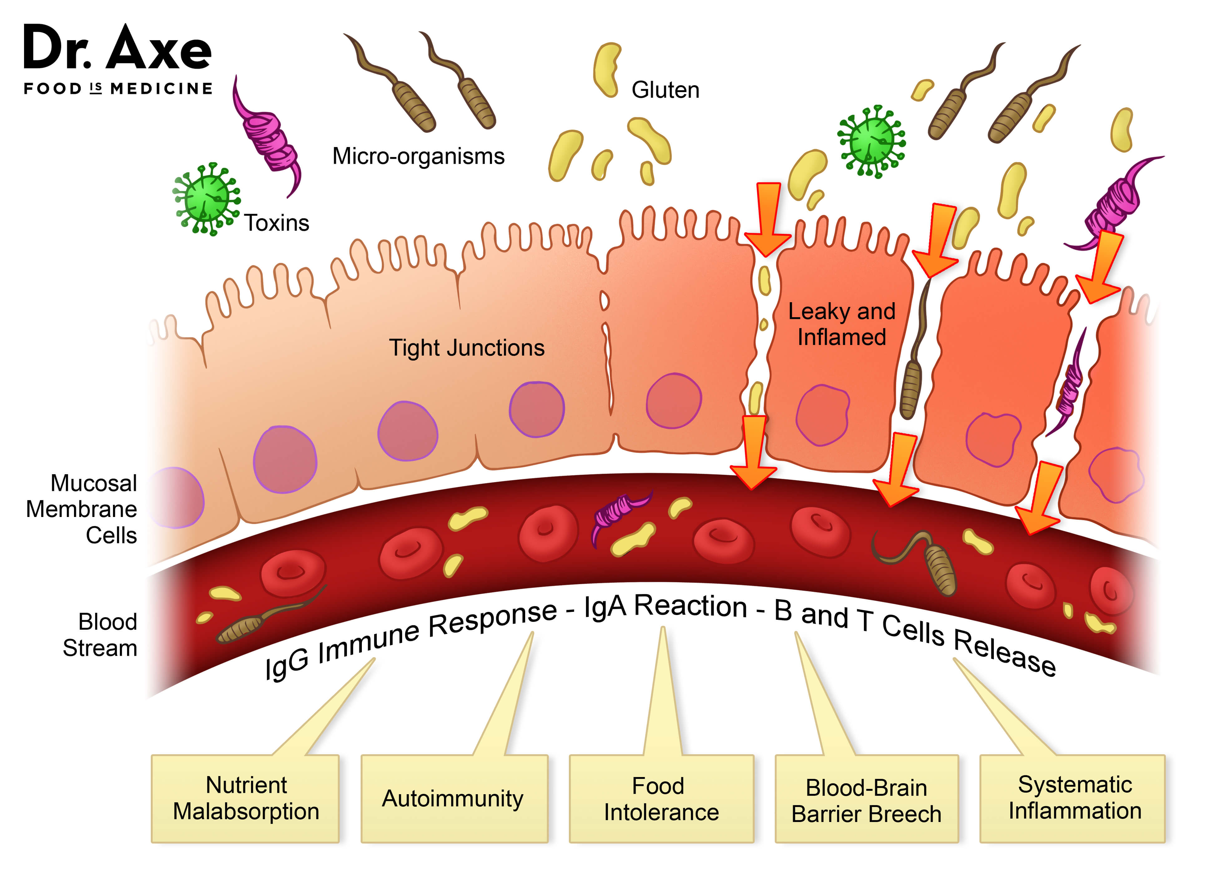 What Is Leaky Gut Syndrome And How Do You Fix It?