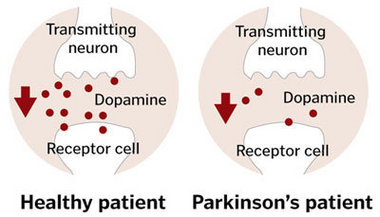 dopamine parkinsons disease - what is dopamine
